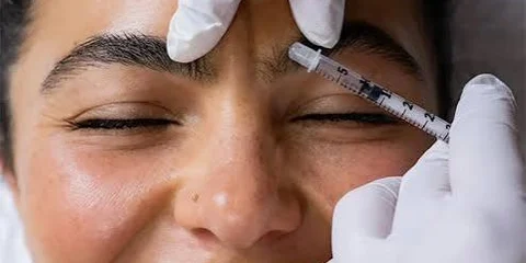 Smiling client receiving a Jeuveau injection at the brow