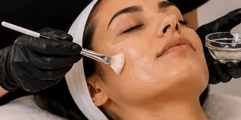 Provider brushing a VI Peel onto a client's cheek
